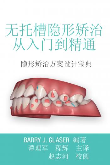 Image of Insider's Guide to Invisalign Treatment (Chinese Edition)